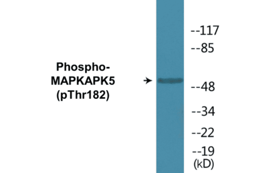 Western Blot - MAPKAPK5 (phospho Thr182) Cell Based ELISA Kit (CBP1825) - Antibodies.com