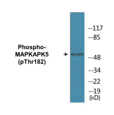 Western Blot - MAPKAPK5 (phospho Thr182) Cell Based ELISA Kit (CBP1825) - Antibodies.com