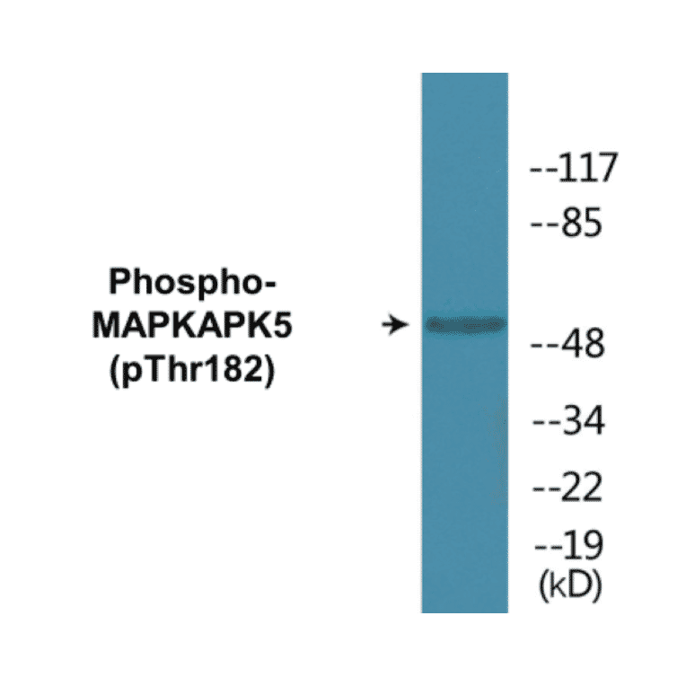 Western Blot - MAPKAPK5 (phospho Thr182) Cell Based ELISA Kit (CBP1825) - Antibodies.com