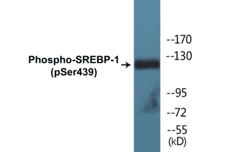 Western Blot - SREBP-1 (phospho Ser439) Cell Based ELISA Kit (CBP1839) - Antibodies.com
