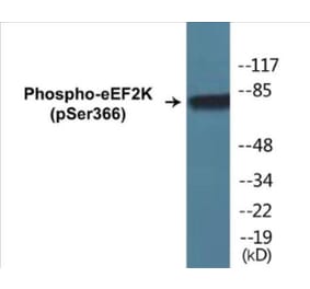 Western Blot - eEF2K (phospho Ser366) Cell Based ELISA Kit (CBP1064) - Antibodies.com