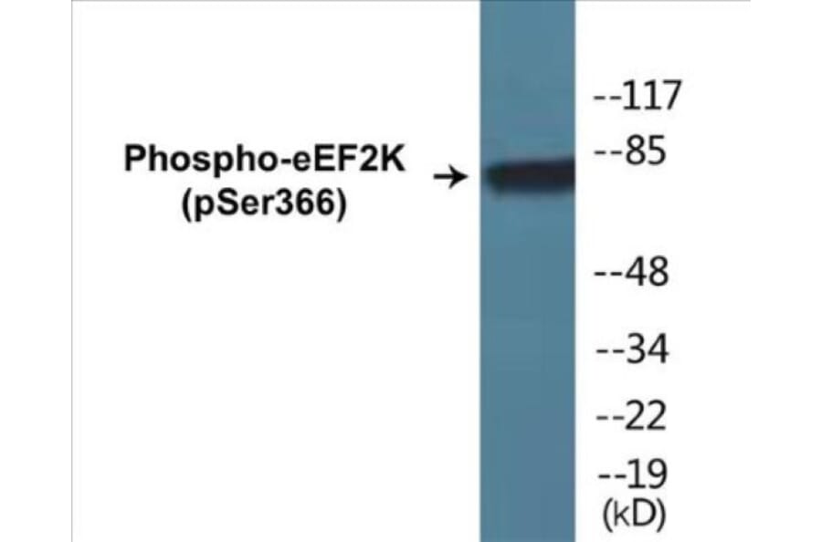 Western Blot - eEF2K (phospho Ser366) Cell Based ELISA Kit (CBP1064) - Antibodies.com