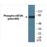 Western Blot - eEF2K (phospho Ser366) Cell Based ELISA Kit (CBP1064) - Antibodies.com