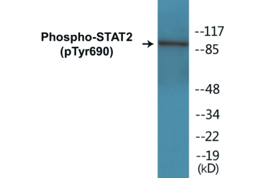 Western Blot - STAT2 (phospho Tyr690) Cell Based ELISA Kit (CBP1082) - Antibodies.com