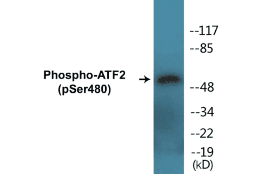 Western Blot - ATF2 (phospho Ser480) Cell Based ELISA Kit (CBP1320) - Antibodies.com