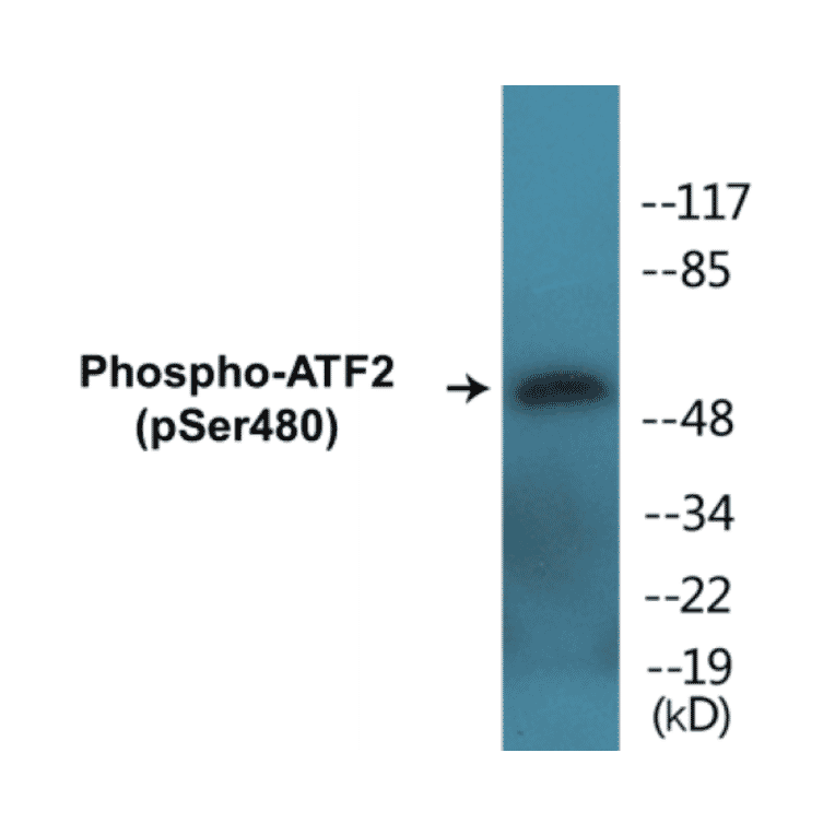 Western Blot - ATF2 (phospho Ser480) Cell Based ELISA Kit (CBP1320) - Antibodies.com