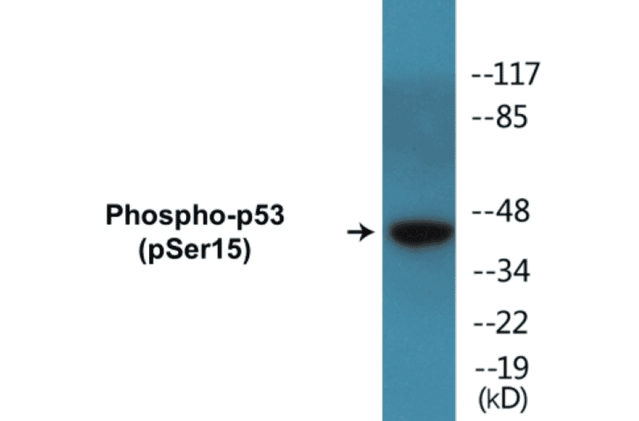 Western Blot - p53 (phospho Ser15) Cell Based ELISA Kit (CBP1642) - Antibodies.com