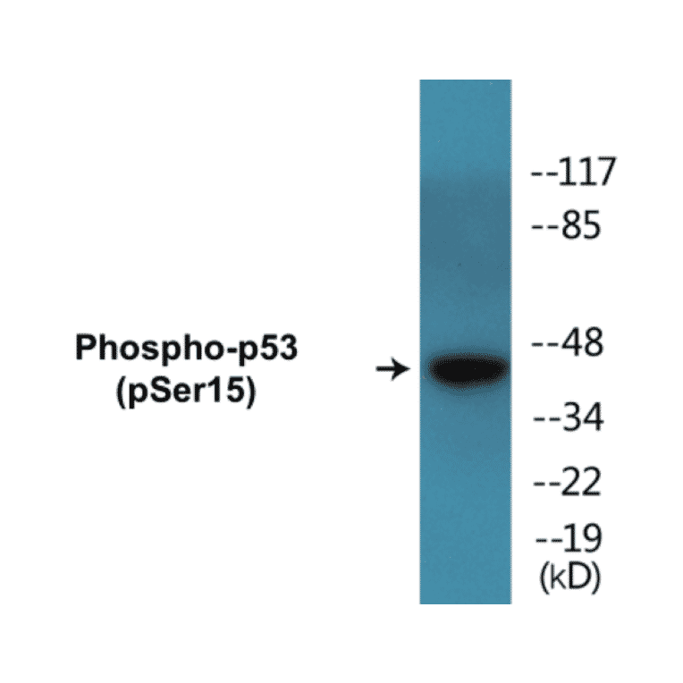 Western Blot - p53 (phospho Ser15) Cell Based ELISA Kit (CBP1642) - Antibodies.com
