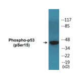 Western Blot - p53 (phospho Ser15) Cell Based ELISA Kit (CBP1642) - Antibodies.com