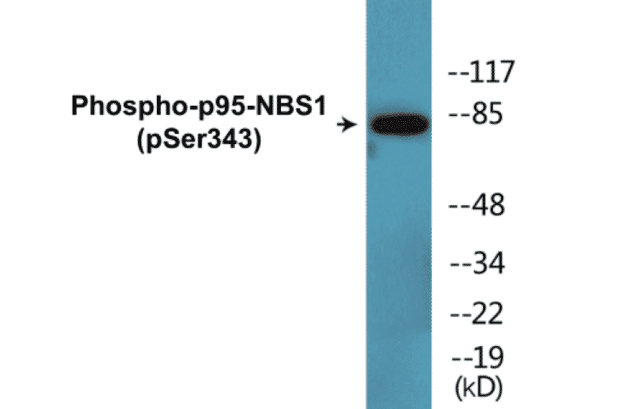 Western Blot - p95-NBS1 (phospho Ser343) Cell Based ELISA Kit (CBP1622) - Antibodies.com