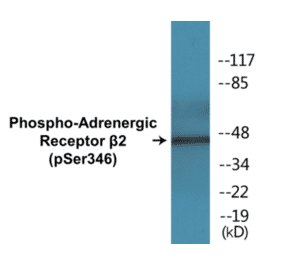 Western Blot - Adrenergic Receptor beta 2 (phospho Ser346) Cell Based ELISA Kit (CBP1443) - Antibodies.com