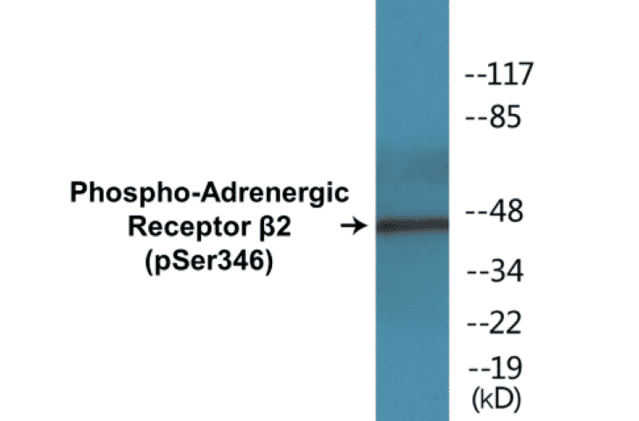 Western Blot - Adrenergic Receptor beta 2 (phospho Ser346) Cell Based ELISA Kit (CBP1443) - Antibodies.com