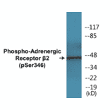 Western Blot - Adrenergic Receptor beta 2 (phospho Ser346) Cell Based ELISA Kit (CBP1443) - Antibodies.com