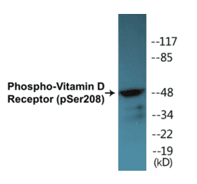 Western Blot - Vitamin D Receptor (phospho Ser208) Cell Based ELISA Kit (CBP1486) - Antibodies.com