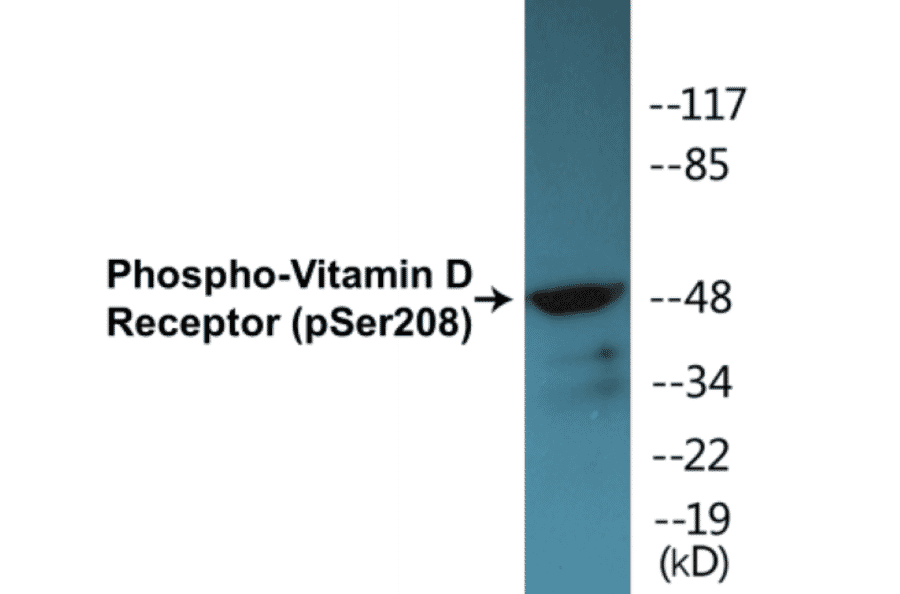 Western Blot - Vitamin D Receptor (phospho Ser208) Cell Based ELISA Kit (CBP1486) - Antibodies.com
