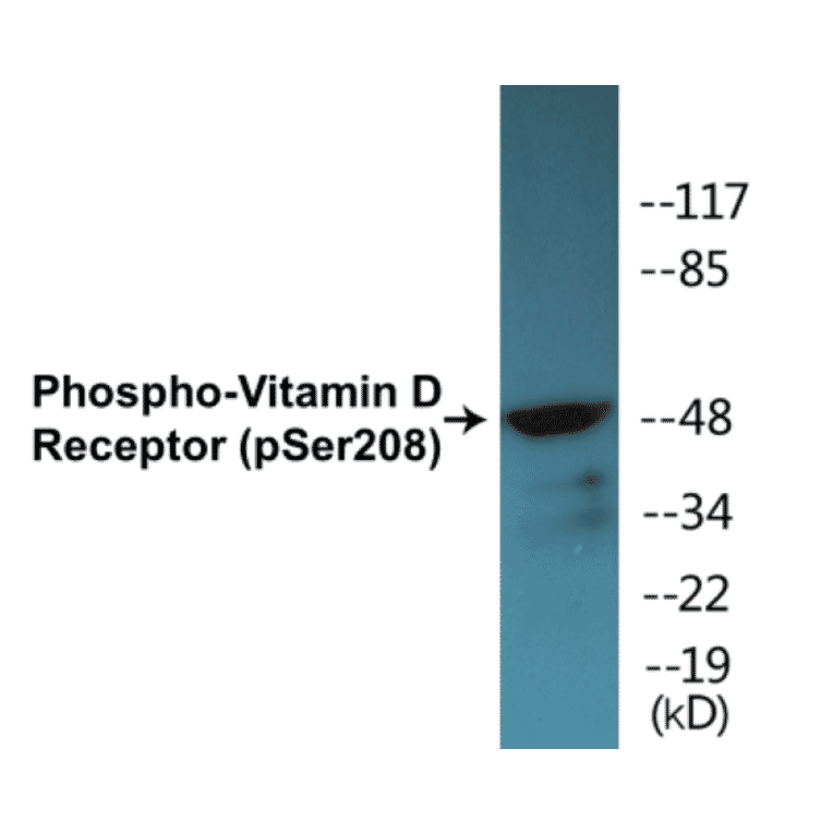 Western Blot - Vitamin D Receptor (phospho Ser208) Cell Based ELISA Kit (CBP1486) - Antibodies.com