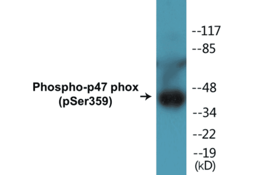 Western Blot - p47phox (phospho Ser359) Cell Based ELISA Kit (CBP1456) - Antibodies.com