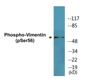 Western Blot - Vimentin (phospho Ser56) Cell Based ELISA Kit (CBP1485) - Antibodies.com
