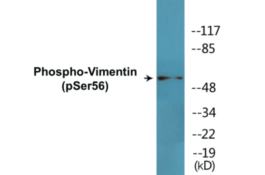 Western Blot - Vimentin (phospho Ser56) Cell Based ELISA Kit (CBP1485) - Antibodies.com