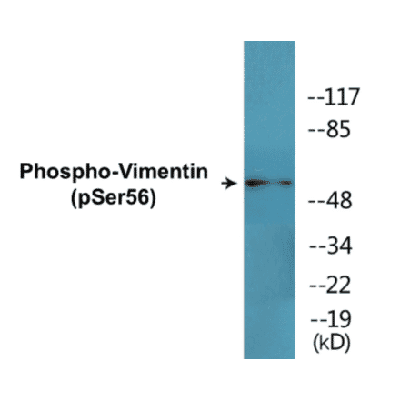 Western Blot - Vimentin (phospho Ser56) Cell Based ELISA Kit (CBP1485) - Antibodies.com