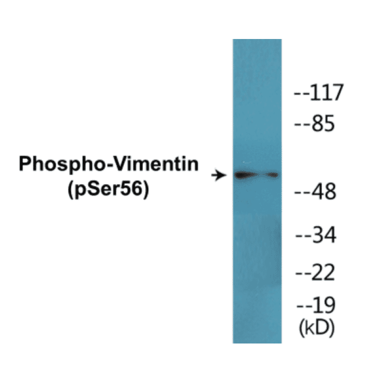 Western Blot - Vimentin (phospho Ser56) Cell Based ELISA Kit (CBP1485) - Antibodies.com