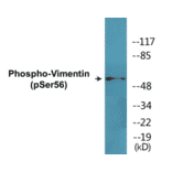 Western Blot - Vimentin (phospho Ser56) Cell Based ELISA Kit (CBP1485) - Antibodies.com