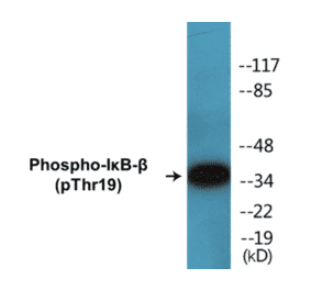 Western Blot - I?B beta (phospho Thr19) Cell Based ELISA Kit (CBP1125) - Antibodies.com