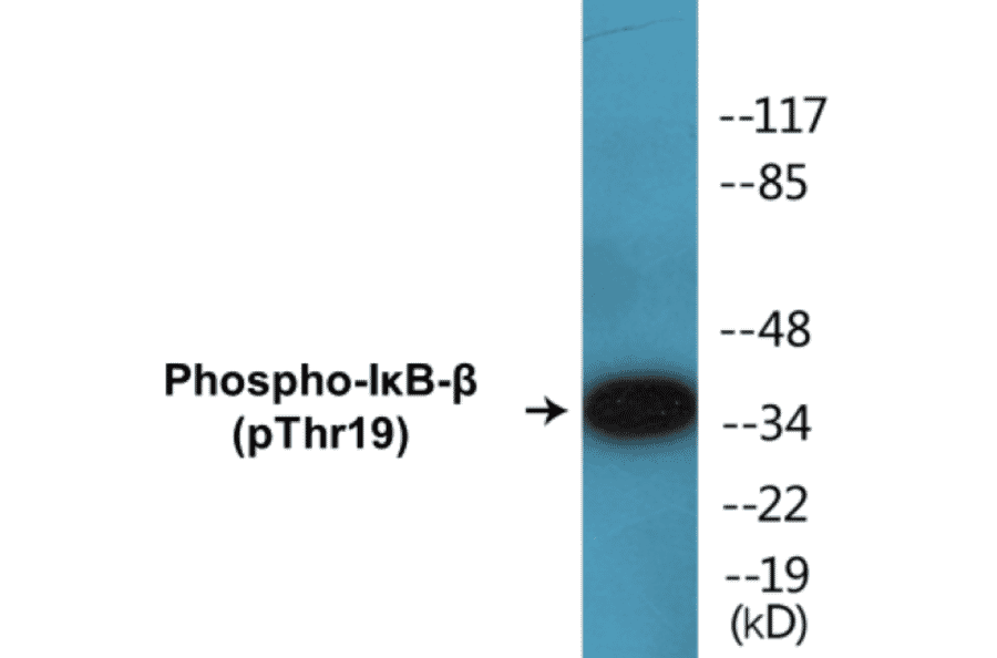 Western Blot - IκB beta (phospho Thr19) Cell Based ELISA Kit (CBP1125) - Antibodies.com