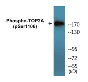 Western Blot - TOP2A (phospho Ser1106) Cell Based ELISA Kit (CBP1442) - Antibodies.com