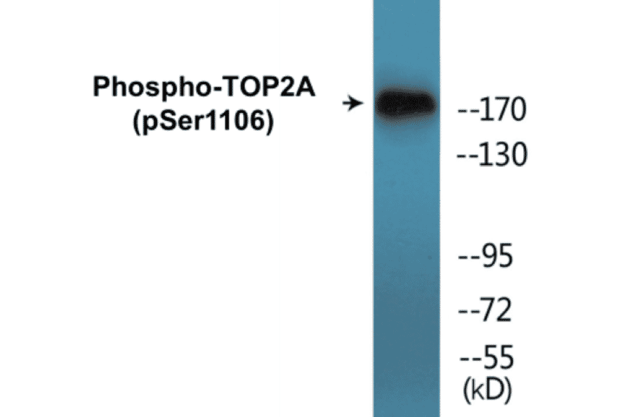 Western Blot - TOP2A (phospho Ser1106) Cell Based ELISA Kit (CBP1442) - Antibodies.com