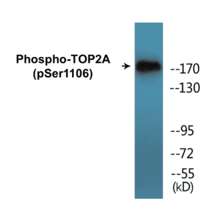 Western Blot - TOP2A (phospho Ser1106) Cell Based ELISA Kit (CBP1442) - Antibodies.com