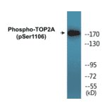 Western Blot - TOP2A (phospho Ser1106) Cell Based ELISA Kit (CBP1442) - Antibodies.com