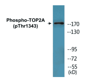 Western Blot - TOP2A (phospho Thr1343) Cell Based ELISA Kit (CBP1787) - Antibodies.com