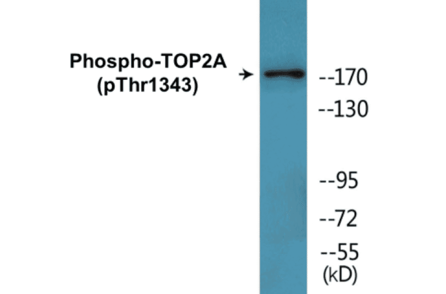 Western Blot - TOP2A (phospho Thr1343) Cell Based ELISA Kit (CBP1787) - Antibodies.com