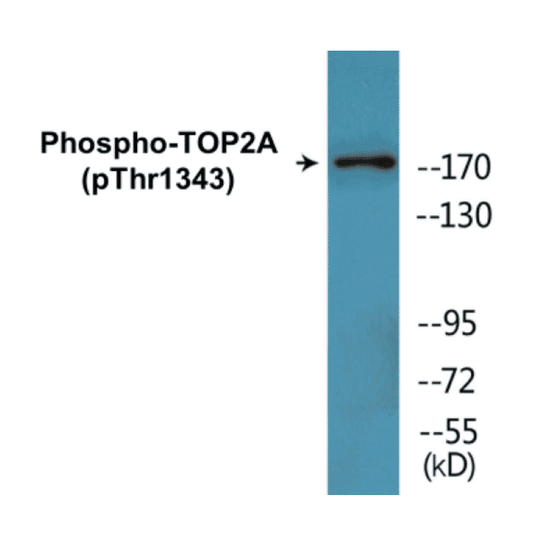 Western Blot - TOP2A (phospho Thr1343) Cell Based ELISA Kit (CBP1787) - Antibodies.com