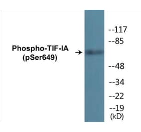Western Blot - TIF-IA (phospho Ser649) Cell Based ELISA Kit (CBP1841) - Antibodies.com