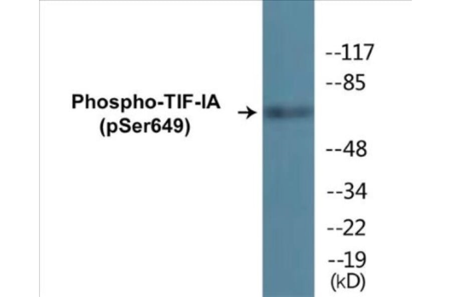 Western Blot - TIF-IA (phospho Ser649) Cell Based ELISA Kit (CBP1841) - Antibodies.com