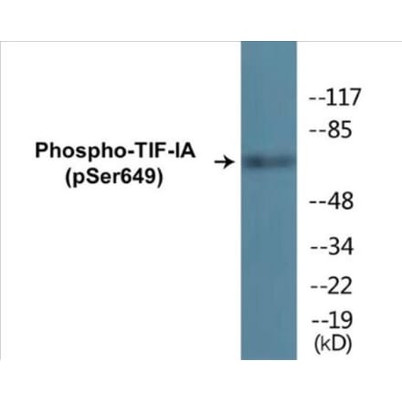 Western Blot - TIF-IA (phospho Ser649) Cell Based ELISA Kit (CBP1841) - Antibodies.com