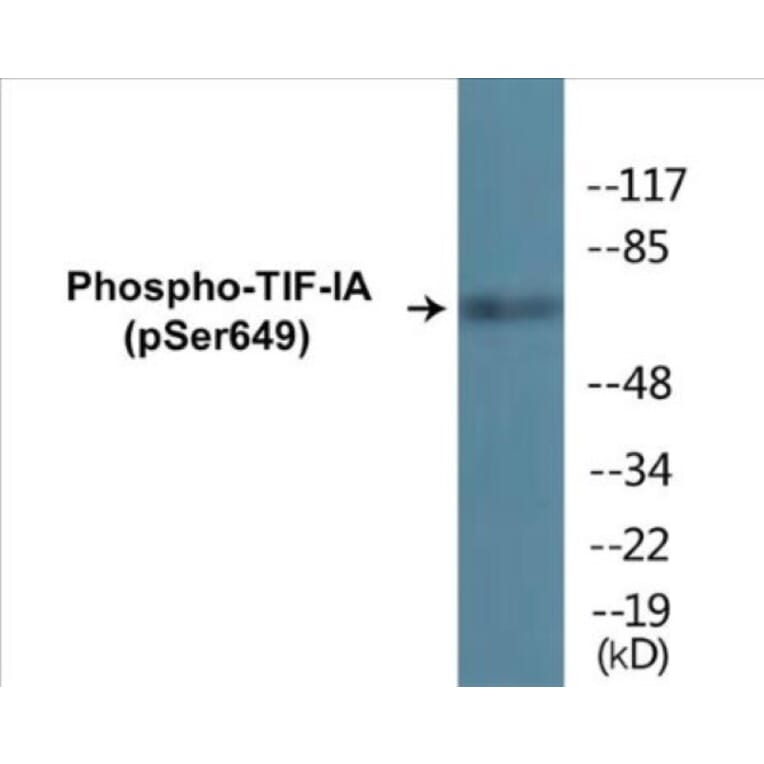 Western Blot - TIF-IA (phospho Ser649) Cell Based ELISA Kit (CBP1841) - Antibodies.com