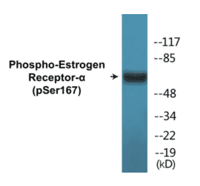 Western Blot - Estrogen Receptor alpha (phospho Ser167) Cell Based ELISA Kit (CBP1549) - Antibodies.com