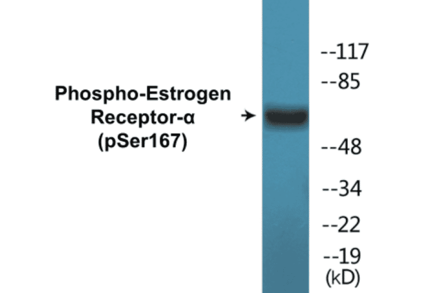 Western Blot - Estrogen Receptor alpha (phospho Ser167) Cell Based ELISA Kit (CBP1549) - Antibodies.com