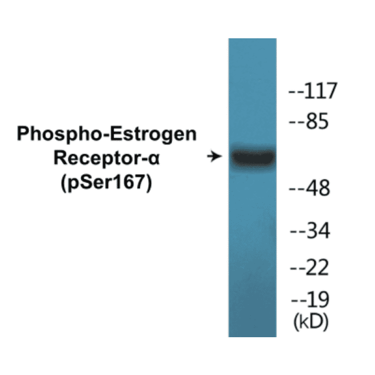 Western Blot - Estrogen Receptor alpha (phospho Ser167) Cell Based ELISA Kit (CBP1549) - Antibodies.com