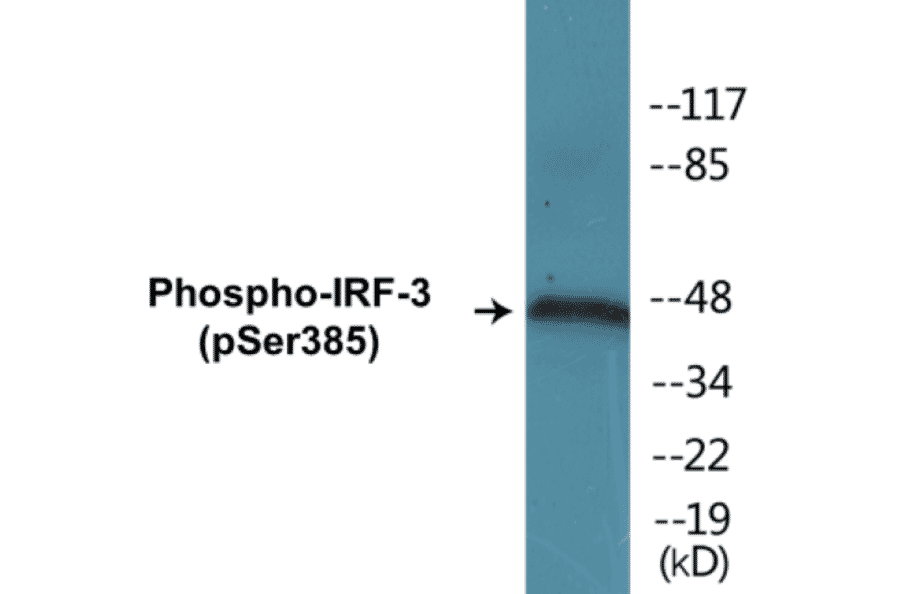 Western Blot - IRF-3 (phospho Ser385) Cell Based ELISA Kit (CBP1166) - Antibodies.com