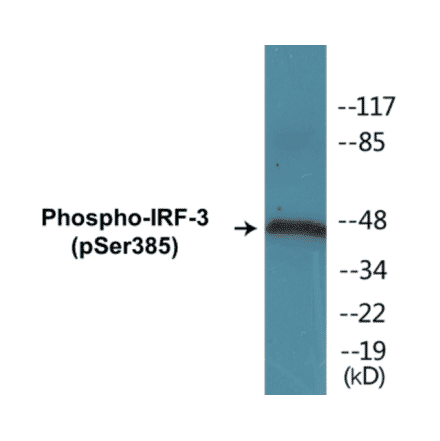 Western Blot - IRF-3 (phospho Ser385) Cell Based ELISA Kit (CBP1166) - Antibodies.com