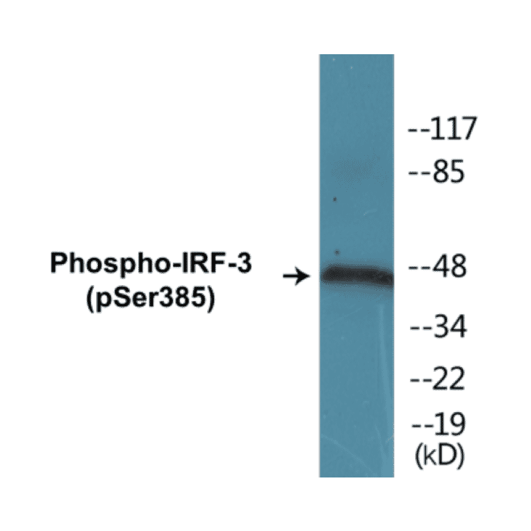 Western Blot - IRF-3 (phospho Ser385) Cell Based ELISA Kit (CBP1166) - Antibodies.com
