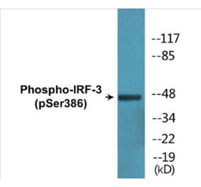 Western Blot - IRF-3 (phospho Ser386) Cell Based ELISA Kit (CBP1776) - Antibodies.com