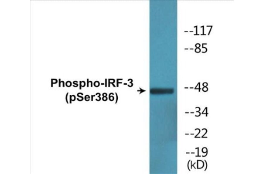 Western Blot - IRF-3 (phospho Ser386) Cell Based ELISA Kit (CBP1776) - Antibodies.com