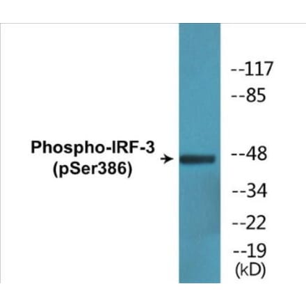 Western Blot - IRF-3 (phospho Ser386) Cell Based ELISA Kit (CBP1776) - Antibodies.com