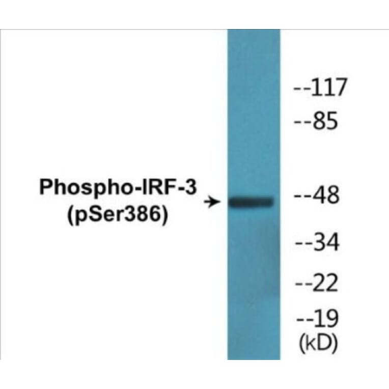 Western Blot - IRF-3 (phospho Ser386) Cell Based ELISA Kit (CBP1776) - Antibodies.com