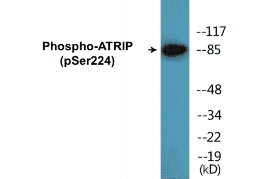 Western Blot - ATRIP (phospho Ser224) Cell Based ELISA Kit (CBP1807) - Antibodies.com